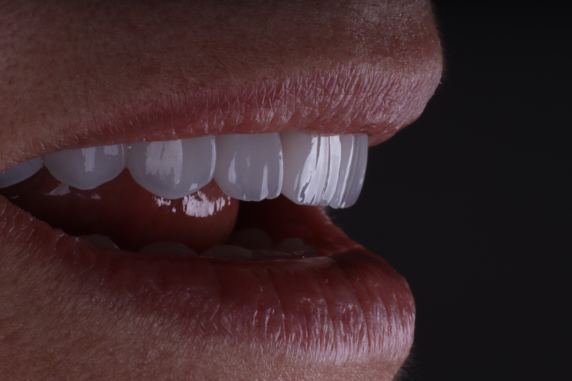 Macro de sorriso natural — textura e translucidez do dente