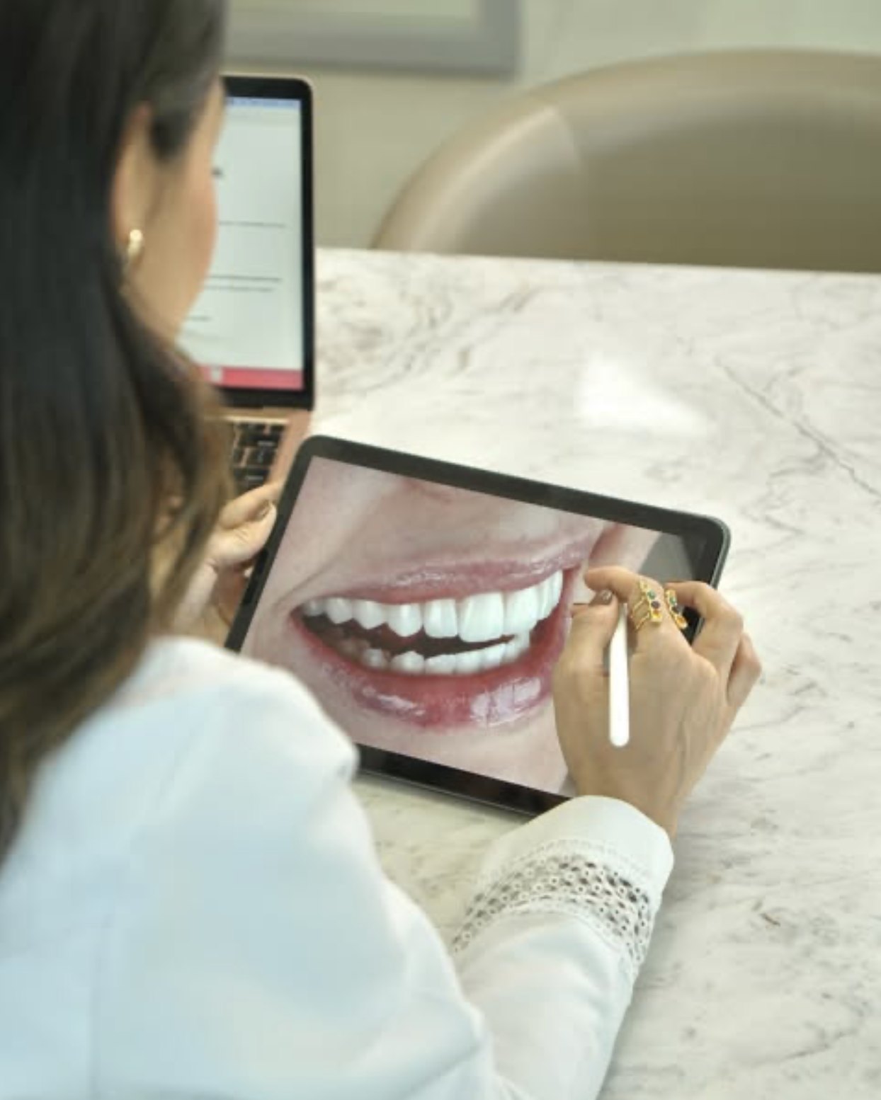 Planejamento digital do sorriso no iPad