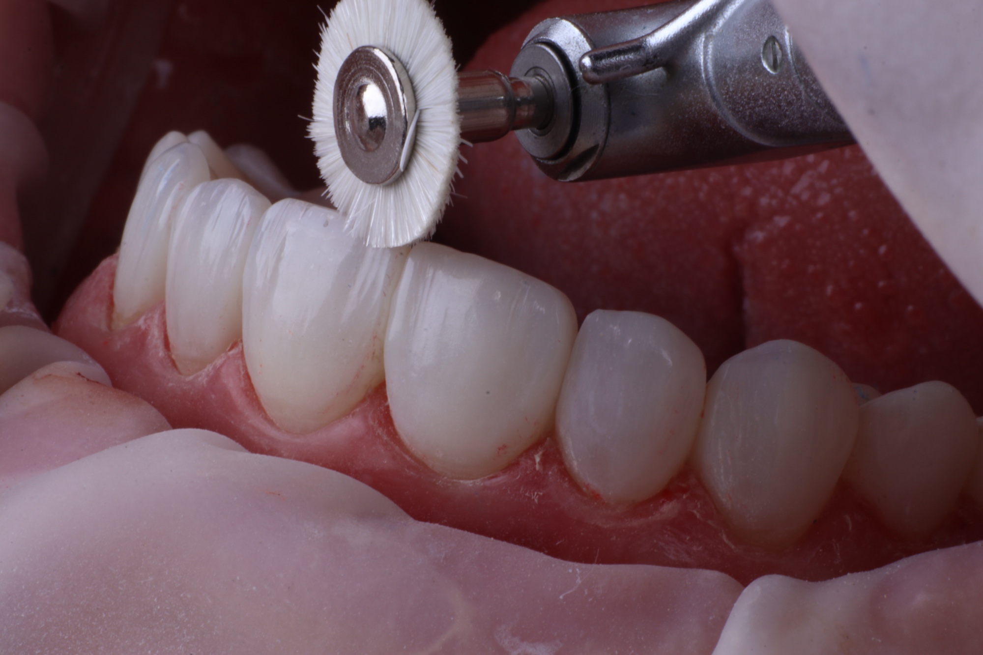 Acabamento e polimento sob magnificação